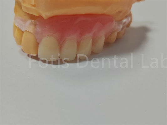 Certificazione FDA/ISO TCS Valplast Protesi flessibili facili da pulire e regolabili