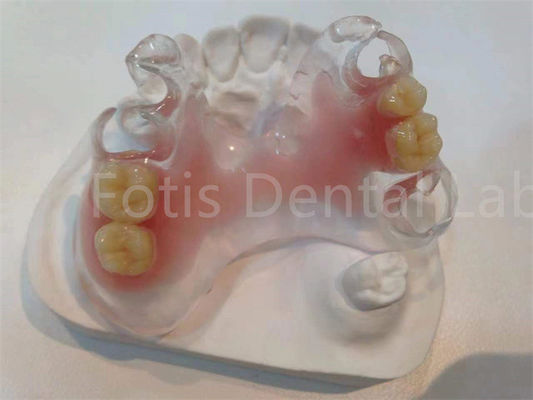 Protesi dentali TCS Valplast ipoallergeniche resistenti alle macchie per un comfort duraturo