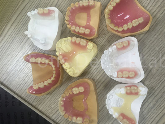 Flessibile TCS Valplast Denti parziali rimovibili Facile da regolare
