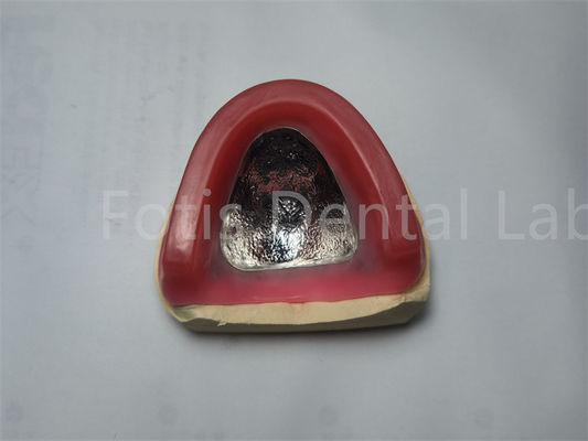 Dentiera lucida rosso ceretta cerniera contorno oclusal confortevole