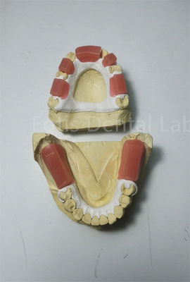 Cera dentale Morso Ringi rosso lucido Rifinitura Unica Relazione di occlusione