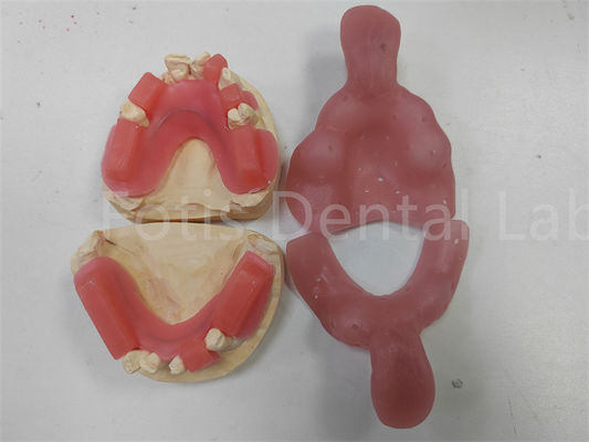 Vibrante rosso gomito per denti superiori o inferiori finitura lucida Peso leggero
