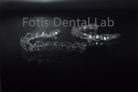 Denti rimovibili, allineatori invisibili, apparecchi dentari invisibili, personalizzazione