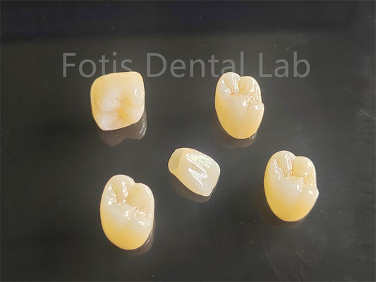 Appello estetico Porcellana completa stratificata in zirconia ideale per ponti corona