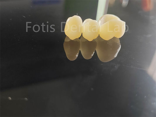 Industria dentale Zirconia stratificata con porcellana soluzione duratura
