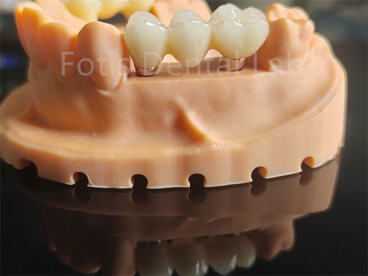 Materiale ceramico ad alta durezza a base di zirconia per applicazioni dentali
