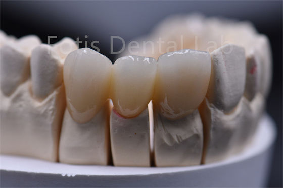 Spessore personalizzabile Materiale dentale in ceramica circonico a più strati