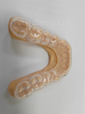 Ergonomico Difficile Morbido Occlusal Guard Morbido Protezione dentale Uso a lungo termine