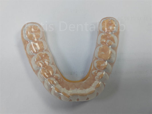 Guardia notturna dura e morbida professionale Manteni i denti sani Protezione dei denti