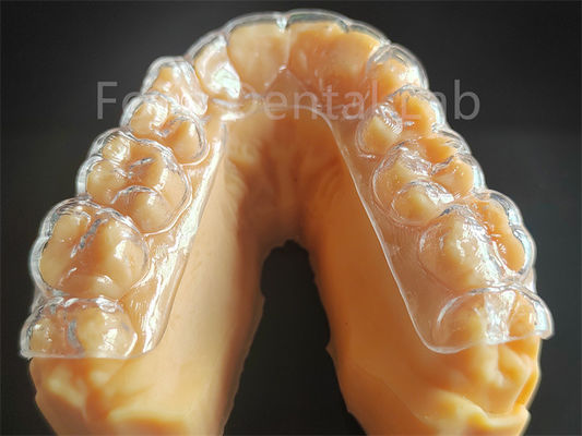 Protezione dentale rigida per la grincatura dei denti