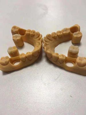 Infissi di ceramica dentale affidabili e precisi e infissi personalizzabili