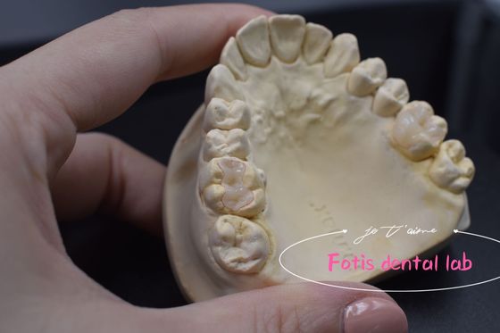 Applicazioni versatili personalizzabili di inchiostro e onlay dentale moderno