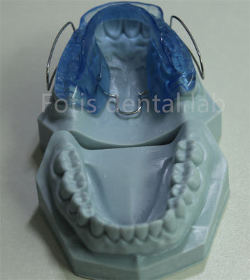 Cina Dental Laboratory Ortodontico Retainer Espansibile regolabile e personalizzabile