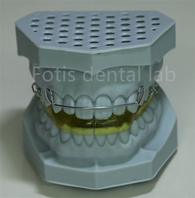Cina Laboratorio dentale Ritenitore di filo linguale per l' espansione dei denti