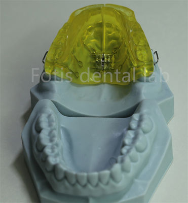 Ritenitore ortodontico personalizzabile per laboratorio dentale cinese