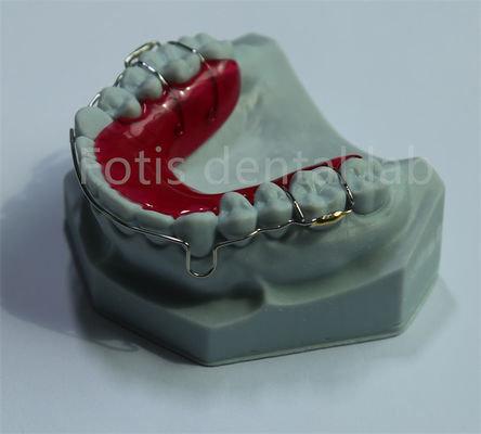Cina Laboratorio dentale Ritenitore di espansione per la ritenzione e l' espansione dentale