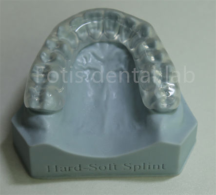 Ritenitore ortodontico regolabile e personalizzabile per la ritenzione e l'espansione dei denti