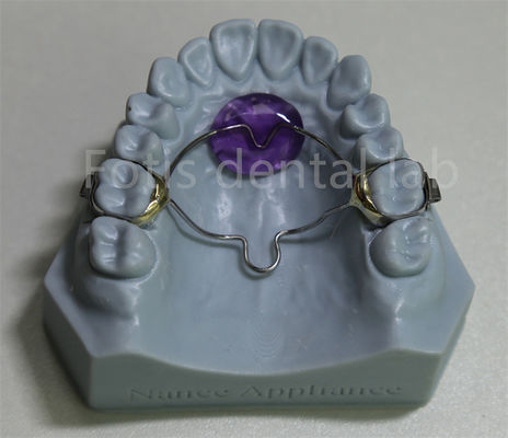 Dental Lab Affordable Ortodontic Expander Retainer Efficace nel trattenere ed espandere i denti