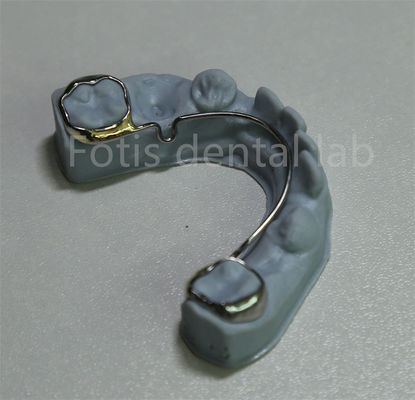 Cina Dental Laboratory Ortodontico Retainer per l' espansione dei denti