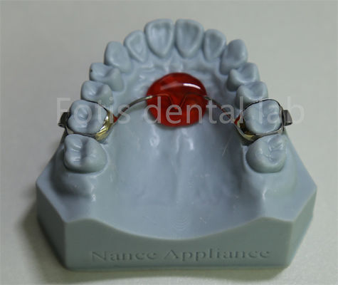 Dental Lab Ortodontic Palatal Expander A prezzi accessibili e compatibile con la maggior parte dei trattamenti
