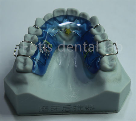 Facile da pulire e mantenere Espansivo Palatale Ortodontico versatile per denti durevoli