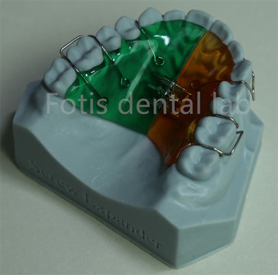 Espansivo ortodontico versatile e confortevole per la ritenzione efficace dei denti