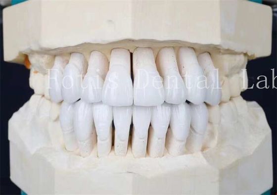 Cimento adesivo e rivestimenti in laminato sintetico ad alta resistenza La coppia perfetta